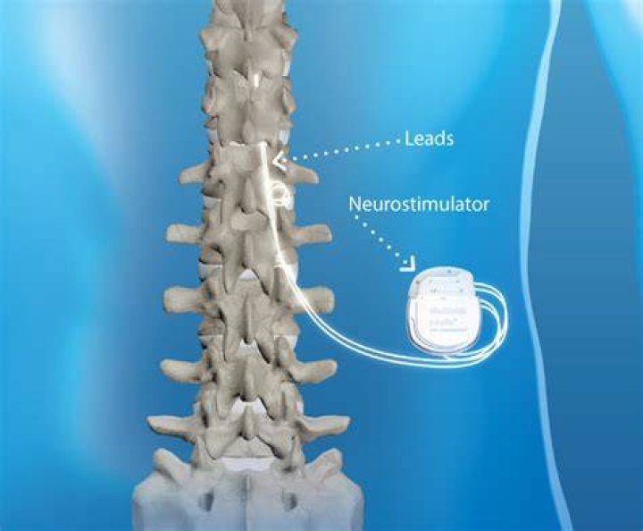 Are Medtronic spinal cord stimulators MRI compatible?