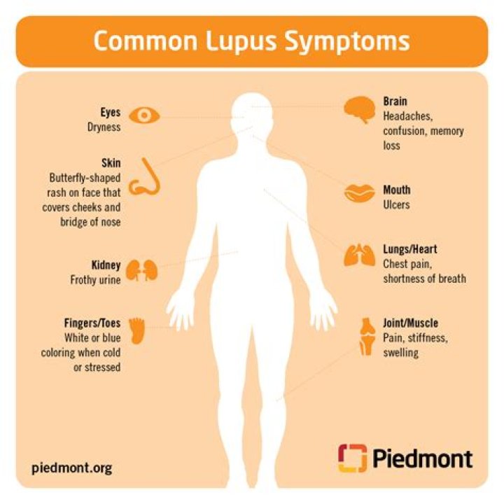 Can lupus cause extreme fatigue?