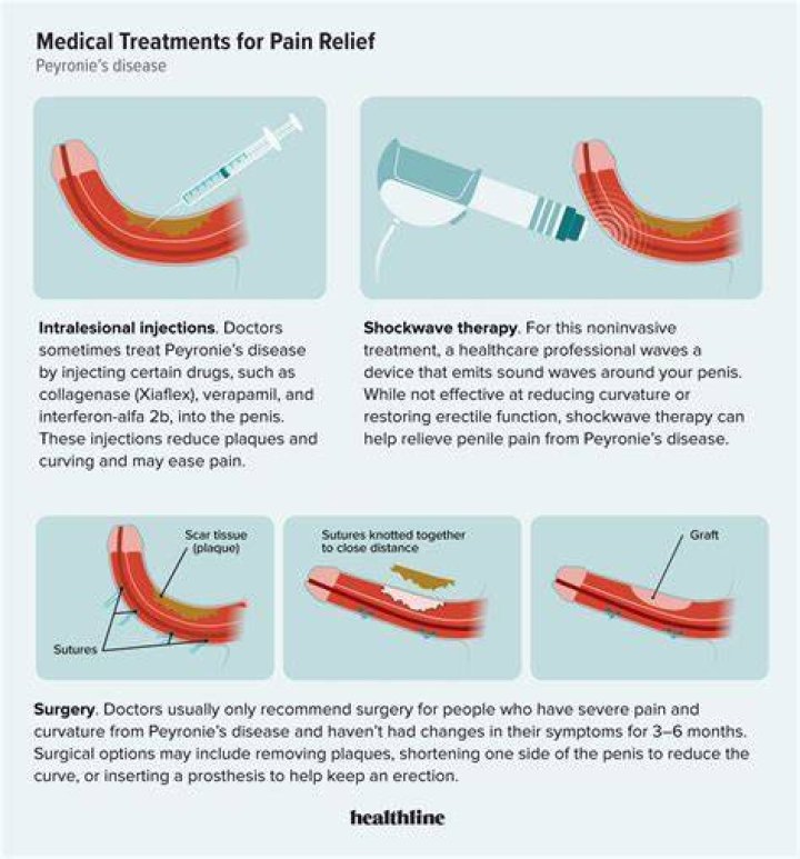 Can peyronies be cured naturally?
