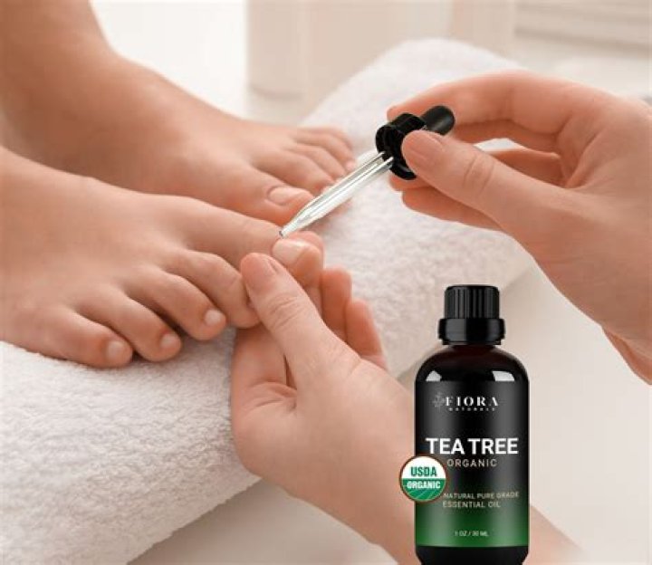 Can you apply tea tree oil directly to toenails?