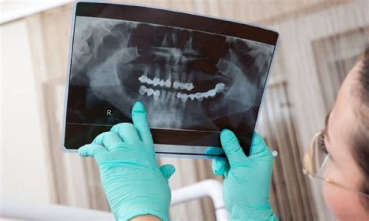 Does the VA hospital have dental?
