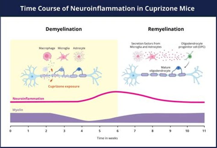 How does Cuprizone cause demyelination?