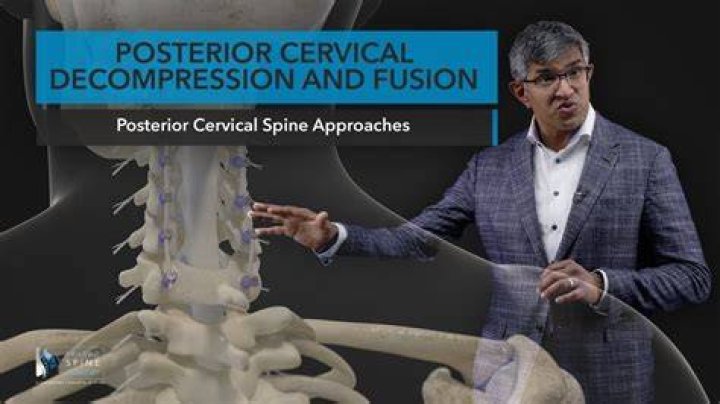 How is cervical decompression done?