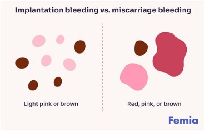 How long should I bleed for after a miscarriage?