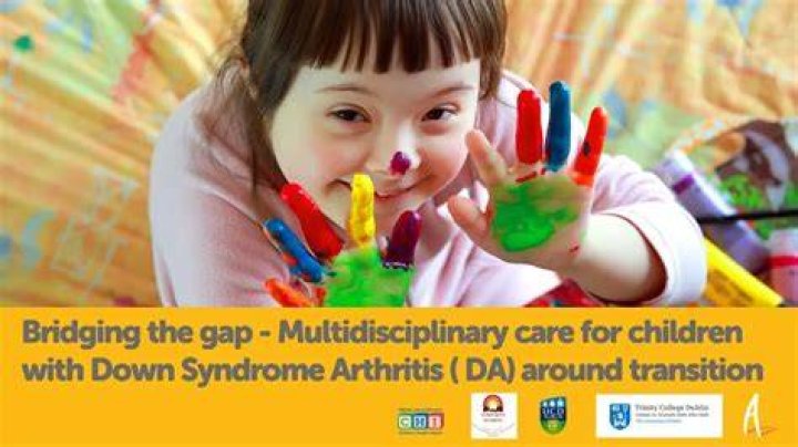 Is arthritis common in Down syndrome?