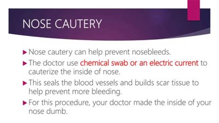 Is cauterizing the nose safe?
