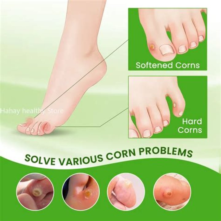 What causes chicken eye on foot?