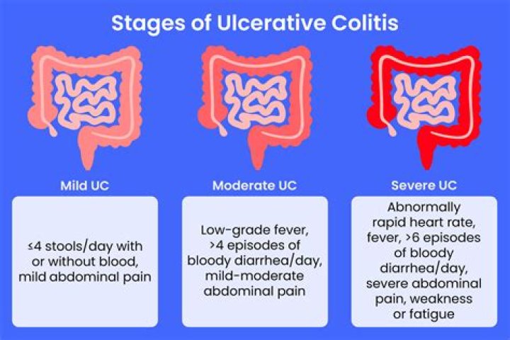 What does UC stand for hospital?